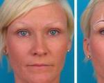Перманентный макияж бровей — Фото «до» и «после», отзывы женщин Что такое перманентный макияж бровей