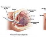 Узи в акушерстве и гинекологии, основные этапы исследования Какие виды узи делают при беременности